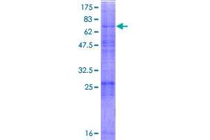 MBTPS2 Protein (AA 1-519) (GST tag)