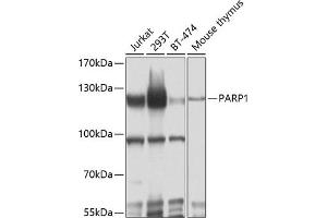 Western blot analysis of extracts of various cell lines, using P antibody (ABIN6134593, ABIN6145233, ABIN6145235 and ABIN6215036) at 1:1000 dilution. (PARP1 Antikörper  (AA 150-250))