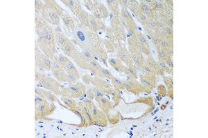 Immunohistochemistry of paraffin-embedded human liver using IGFBP4 antibody at dilution of 1:100 (40x lens).