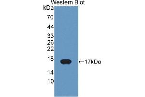 Detection of Recombinant CYP11A1, Bovine using Polyclonal Antibody to Cytochrome P450 11A1 (CYP11A1) (CYP11A1 Antikörper  (AA 391-515))