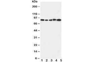 Western blot testing of CD18 antibody and Lane 1:  Jurkat cell lysate ;  2: CEM;  3: HT1080;  4: SMMC-7721;  5: HeLa cell lysate.