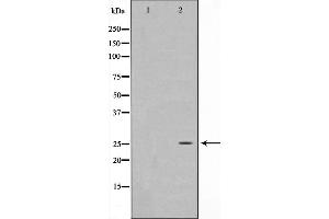 Western blot analysis on HeLa cell lysate using EFNA5 Antibody,The lane on the left is treated with the antigen-specific peptide. (Ephrin A5 Antikörper  (Internal Region))
