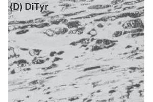 Immunohistochemistry image of dityrosine staining in paraffin section of human atherosclerotic lesion. (Dityrosine Antikörper)