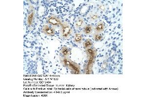 Rabbit Anti-GGTLA4 Antibody  Paraffin Embedded Tissue: Human Kidney Cellular Data: Epithelial cells of renal tubule Antibody Concentration: 4. (GGTLC1 Antikörper  (C-Term))