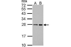 WB Image Sample (30 ug of whole cell lysate) A: A431 B: HeLa 12% SDS PAGE antibody diluted at 1:1000 (BAG2 Antikörper)