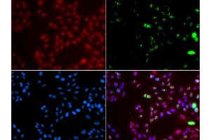 Immunofluorescence analysis of GFP-RNF168 transgenic U2OS cells using XPA antibody. (XPA Antikörper)