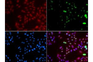 Immunofluorescence analysis of GFP-RNF168 transgenic U2OS cells using XPA antibody. (XPA Antikörper)
