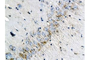 Immunohistochemistry (IHC) image for anti-CD46 (CD46) (AA 251-355) antibody (ABIN687832)