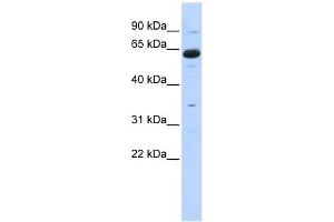 Copine I antibody used at 1 ug/ml to detect target protein.