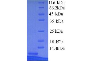 SDS-PAGE (SDS) image for Metallothionein 1X (MT1X) (AA 1-59), (partial) protein (His tag) (ABIN5713674)