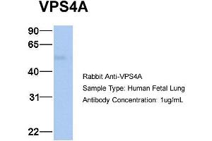 Host: Rabbit Target Name: VPS4A Sample Type: Human Fetal Lung Antibody Dilution: 1. (VPS4A Antikörper  (N-Term))