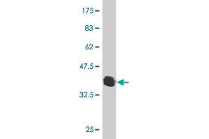 Western Blot detection against Immunogen (36. (RNF133 Antikörper  (AA 277-376))
