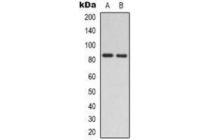 Western blot analysis of RAD54A expression in Jurkat (A), HEK293T (B) whole cell lysates. (RAD54L Antikörper)