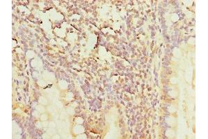 Immunohistochemistry of paraffin-embedded human small intestine tissue using ABIN7150446 at dilution of 1:100