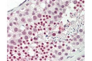 anti-Retinoblastoma Binding Protein 6 (RBBP6) (AA 1582-1692) antibody