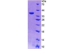 SDS-PAGE analysis of Human CISH Protein. (CISH Protein)