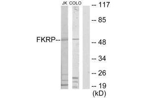 Western blot analysis of extracts from Jurkat cells and COLO205 cells, using FKRP antibody. (FKRP Antikörper  (N-Term))