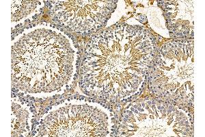 ABIN7095482 and ABIN7099539 at 1/100 staining rat testis tissue by IHC-P. (SOCS4 Antikörper)