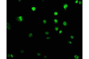 Immunofluorescence staining of U251 cells with ABIN7151309 at 1:100, counter-stained with DAPI. (UHRF2 Antikörper  (AA 444-585))