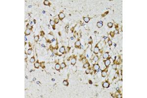 Immunohistochemistry of paraffin-embedded mouse brain using RPN1 antibody. (RPN1 Antikörper)