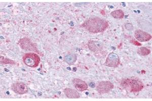 Anti-NPY1R antibody  ABIN1049122 IHC staining of human brain. (NPY1R Antikörper  (Cytoplasmic Domain))