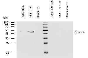 Western Blotting (WB) image for anti-Solute Carrier Family 9, Subfamily A (NHE3, Cation Proton Antiporter 3), Member 3 Regulator 1 (SLC9A3R1) antibody (ABIN94437)