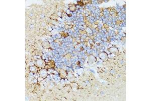 Immunohistochemistry of paraffin-embedded rat cerebellum using NEFH antibody (ABIN5974903) at dilution of 1/100 (40x lens). (NEFH Antikörper)