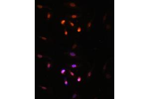 Immunofluorescence analysis of U2OS cells using KA antibody (ABIN7268768) at dilution of 1:100. (MYST3 Antikörper  (AA 800-1000))