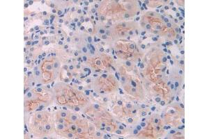 Used in DAB staining on fromalin fixed paraffin- embedded kidney tissue (CLTA Antikörper  (AA 5-234))
