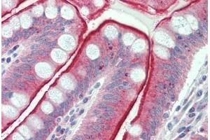 Anti-CDHR5 / MUPCDH antibody  ABIN960756 IHC staining of human small intestine.