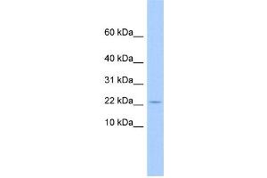 WB Suggested Anti-C10orf132 Antibody Titration: 0. (GOLGA7B Antikörper  (N-Term))