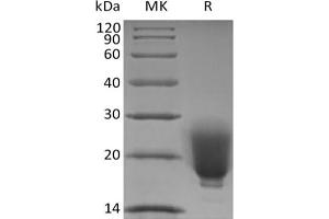 Western Blotting (WB) image for Fibronectin Type III Domain Containing 5 (FNDC5) protein (His tag) (ABIN7319826) (FNDC5 Protein (His tag))