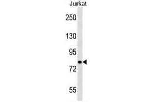 CACNB2 Antibody (Center) western blot analysis in Jurkat cell line lysates (35µg/lane). (CACNB2 Antikörper  (Middle Region))