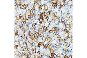 Immunohistochemistry of paraffin-embedded rat ovary using J Rabbit mAb (ABIN7268036) at dilution of 1:100 (40x lens). (JAK1 Antikörper)