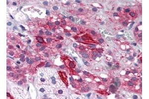 Human Adrenal (formalin-fixed, paraffin-embedded) stained with GRIK1at 5 µg/ml followed by biotinylated goat anti-rabbit IgG secondary antibody, alkaline phosphatase-streptavidin and chromogen. (GRIK1 Antikörper  (Center))