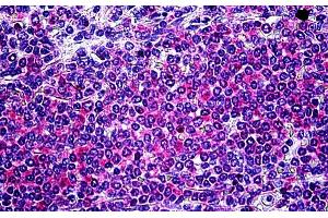 Immunohistochemistry (IHC) image for anti-IL2-Inducible T-Cell Kinase (ITK) (Internal Region) antibody (ABIN1589997)