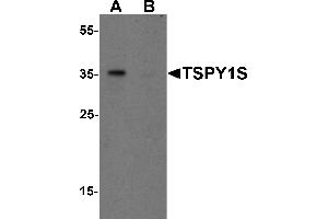 Western Blotting (WB) image for anti-TSPY1S (C-Term) antibody (ABIN1077409) (TSPY1S (C-Term) Antikörper)