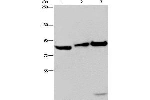 Western Blot analysis of NIH/3T3 cell, Mouse lung and liver tissue using MAPRE3 Polyclonal Antibody at dilution of 1:550 (ECE1 Antikörper)