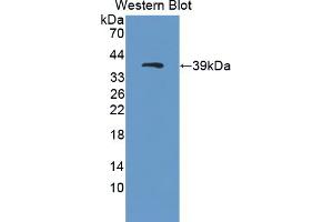 Figure. (PCDHGA2 Antikörper  (AA 29-347))