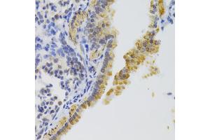 Immunohistochemistry of paraffin-embedded mouse lung using KIF1B Antibody (ABIN2563552) at dilution of 1:100 (40x lens). (KIF1B Antikörper)
