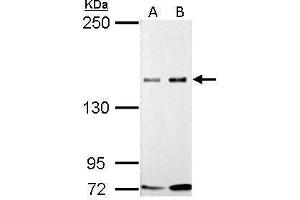 WB Image GLI3 antibody detects GLI3 protein by Western blot analysis. (GLI3 Antikörper)