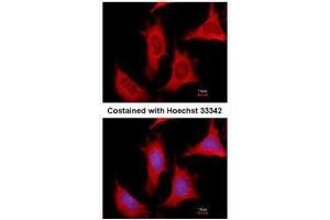 ICC/IF Image Immunofluorescence analysis of methanol-fixed HeLa, using PPAT, antibody at 1:500 dilution. (PPAT Antikörper)
