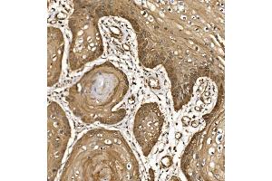 IHC analysis of EIF5 using anti-EIF5 antibody (ABIN7599722).