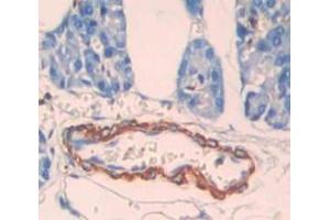 IHC-P analysis of Human Tissue, with DAB staining. (CPT1B Antikörper  (AA 602-772))