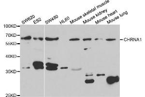 Western Blotting (WB) image for anti-Acetylcholine Receptor Subunit alpha (CHRNA1) antibody (ABIN1876494) (CHRNA1 Antikörper)