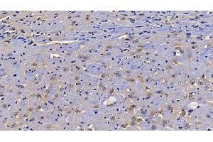 Detection of TOLLIP in Mouse Cerebrum Tissue using Polyclonal Antibody to Toll Interacting Protein (TOLLIP) (TOLLIP Antikörper  (AA 19-254))