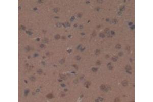IHC-P analysis of Rat Tissue, with DAB staining. (Ceruloplasmin Antikörper  (AA 872-1059))