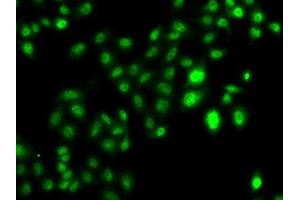 Immunofluorescence analysis of U2OS cells using CBFA2T2 antibody.
