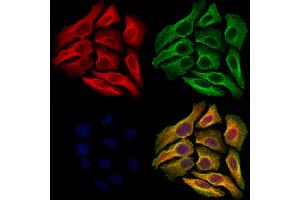 ABIN6264177 and ABIN6273064 staining Hela cells by IF/ICC. (PHGDH Antikörper  (N-Term))