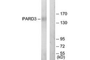 Western blot analysis of extracts from COLO205 cells, using PARD3 Antibody. (PARD3 Antikörper  (AA 1141-1190))